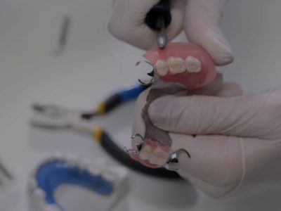 full and partial dentures being put together by a dentist at Williams Dental